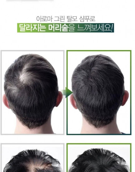 Шампунь против выпадения волос «Etre doux Aroma Green Shampoo»