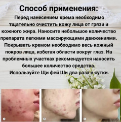 Крем для лица от прыщей и угрей - Фото 3