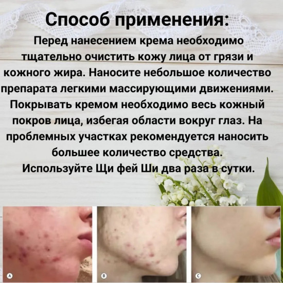 Крем для лица от прыщей и угрей