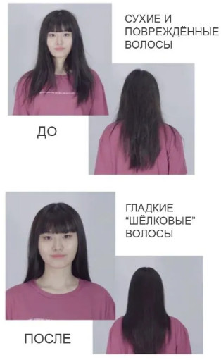 Шампунь от перхоти с яблочным уксусом «5 Probiotics Apple Vinergar Shampoo»