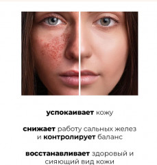 Успокаивающий эко-тонер для лица с центеллой «Centella Water Alcohol-Free Toner» - Фото 1