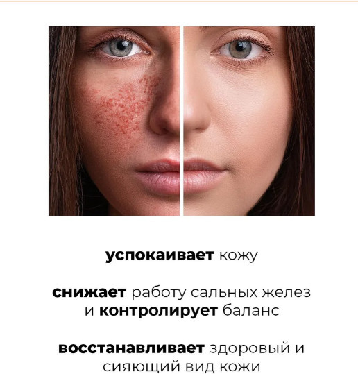 Успокаивающий эко-тонер для лица с центеллой «Centella Water Alcohol-Free Toner»