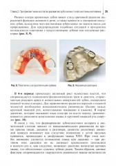 Диагностика и профилактика стоматологических заболеваний при первичной доврачебной медико-санитарной помощи - Фото 11