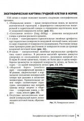 Ультразвуковое исследование легких у детей при пневмонии - Фото 10