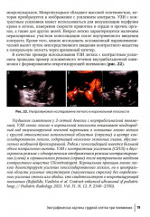 Ультразвуковое исследование легких у детей при пневмонии - Фото 14