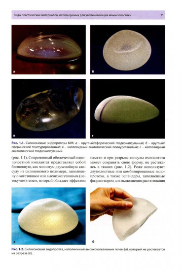 Руководство по ультразвуковому исследованию молочных желез до увеличивающей маммопластики и после нее