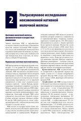 Руководство по ультразвуковому исследованию молочных желез до увеличивающей маммопластики и после нее - Фото 8
