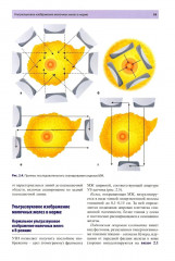 Руководство по ультразвуковому исследованию молочных желез до увеличивающей маммопластики и после нее - Фото 14