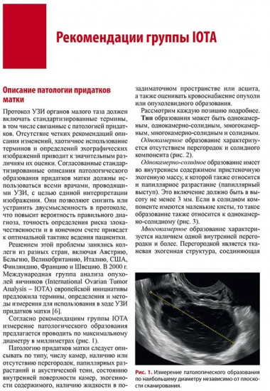Стандартизация ультразвукового исследования патологии придатков матки по IOTA, O-RADS