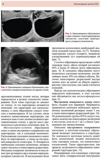 Стандартизация ультразвукового исследования патологии придатков матки по IOTA, O-RADS