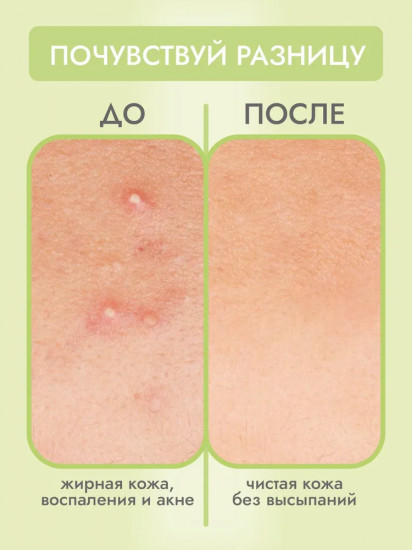 Пенка для умывания для жирной и проблемной кожи