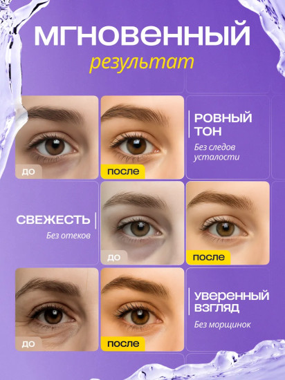 Патчи для глаз с экстрактом муцина улитки