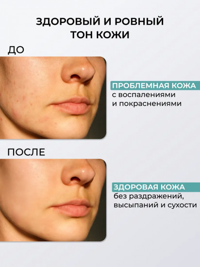 Пилинг-скатка для проблемной и жирной кожи