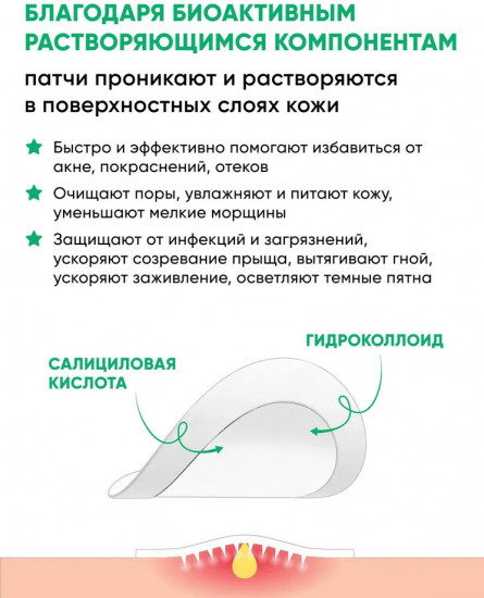 Патчи для лица от прыщей и акне