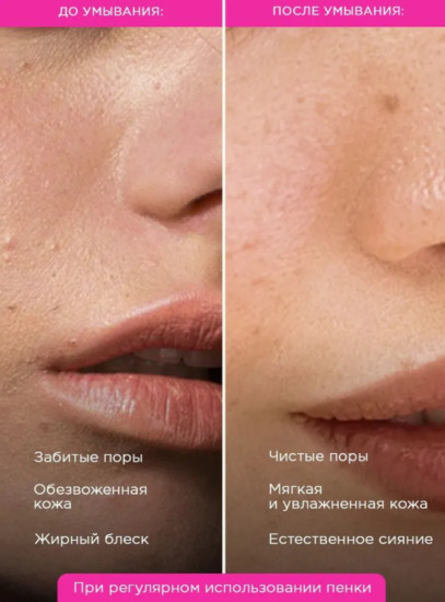 Пенка для умывания лица и снятия макияжа увлажняющая с гиалуроновой кислотой