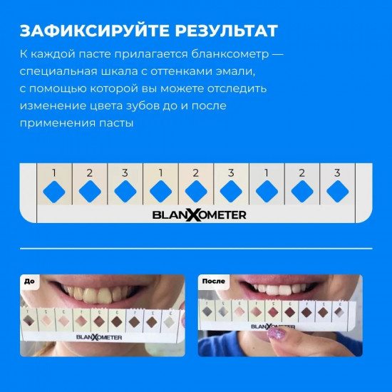 Зубная паста отбеливающая «White Shock»