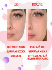 Сыворотка для расширенных пор с 97% гиалуроновой кислоты «Witch Piggy Hell Pore Control Hyaluronic Acid 97%» - Фото 6