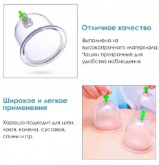 Набор вакуумных массажных банок - Фото 5