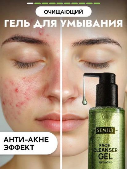 Гель для умывания от акне