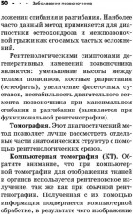 Заболевания позвоночника. Карманный справочник - Фото 16