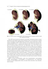 Неотложные урологические состояния. Краткое руководство для врачей - Фото 8