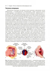 Неотложные урологические состояния. Краткое руководство для врачей - Фото 11