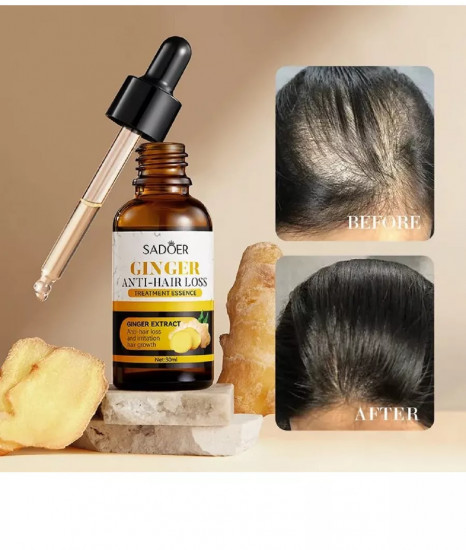 Сыворотка против выпадения волос с экстраком имбиря «Ginger Anti-Hair Loss»