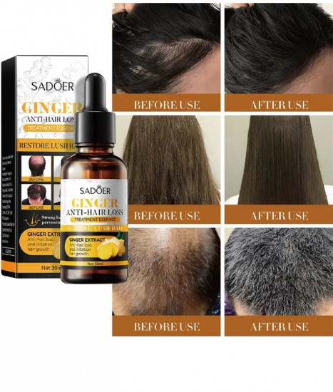 Сыворотка против выпадения волос с экстраком имбиря «Ginger Anti-Hair Loss»