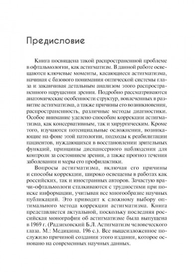 Астигматизм