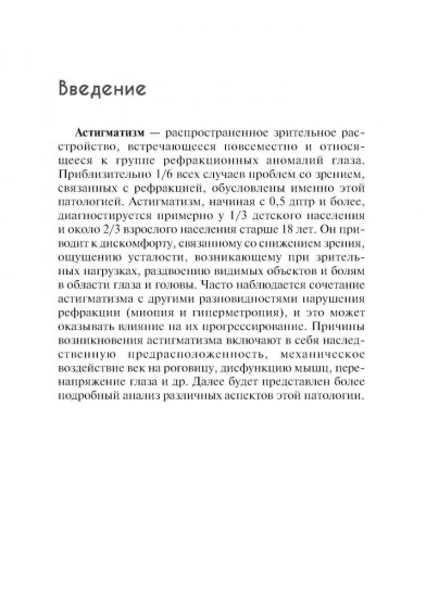 Астигматизм