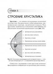 Астигматизм - Фото 4