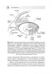 Астигматизм - Фото 6