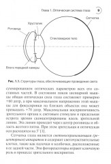 Астигматизм - Фото 9