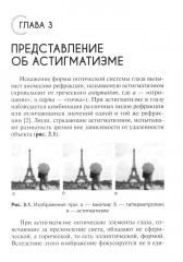 Астигматизм - Фото 11