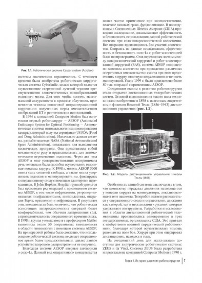 Робот-ассистированная хирургия в гинекологии