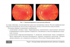Симптомы и синдромы в офтальмологии - Фото 12
