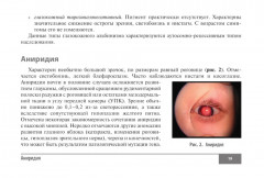 Симптомы и синдромы в офтальмологии - Фото 13