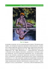 Психические расстройства в подростково-юношеском возрасте (клинические иллюстрации) - Фото 6