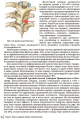 Боли в спине. Применение традиционной, комплементарной и интегративной медицины - Фото 12