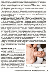 Боли в спине. Применение традиционной, комплементарной и интегративной медицины - Фото 13