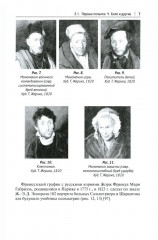 Клиническая иконография в психиатрии - Фото 5