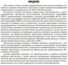 Ишемический инсульт и нетравматическое внутричерепное кровоизлияние. Формализованные протоколы описания РКТ- и МРТ-исследований - Фото 3