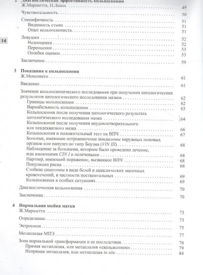 Кольпоскопия. Метод и диагностика