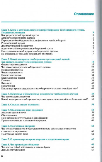 Эндопротезирование тазобедренного сустава. Ответы на все вопросы