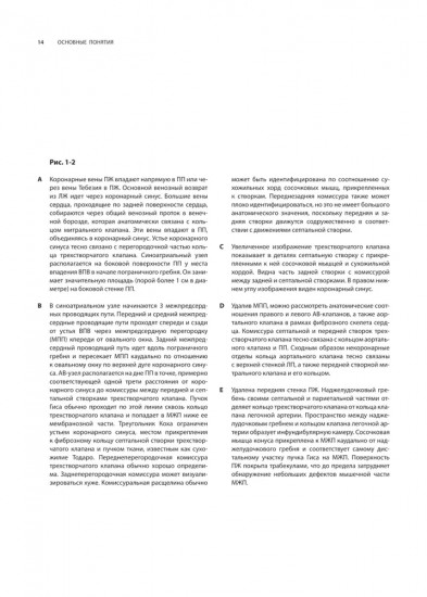 Кардиохирургия. Техника выполнения операций