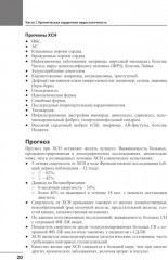 Сердечная недостаточность - Фото 5