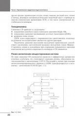 Сердечная недостаточность - Фото 8