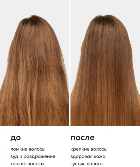 Шампунь для чувствительной кожи головы