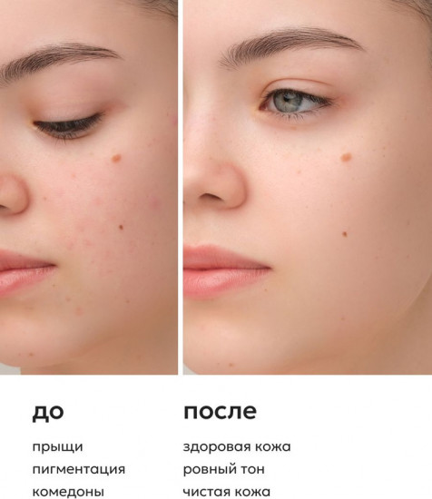 Мультикислотный пилинг для лица с AHА ВНА 30%