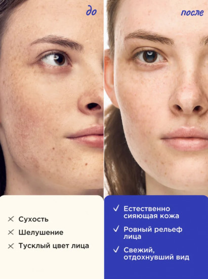 Сыворотка для лица с гиалуроновой кислотой увлажняющая